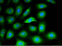 (ibidi)μ-Dish 50 mm低壁培養皿-81136 81131